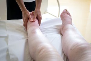 Decongestive lymphedema