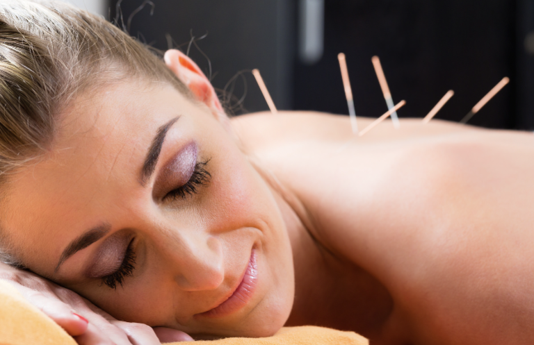 Dry Needling
